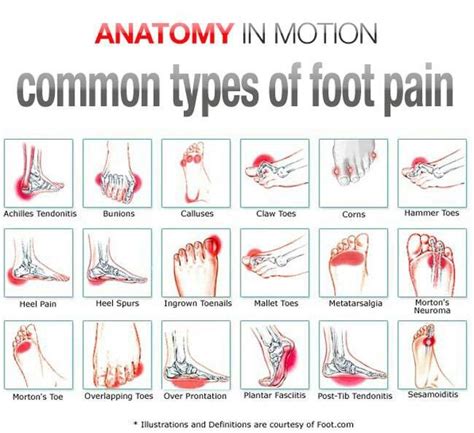 foot pain when standing still